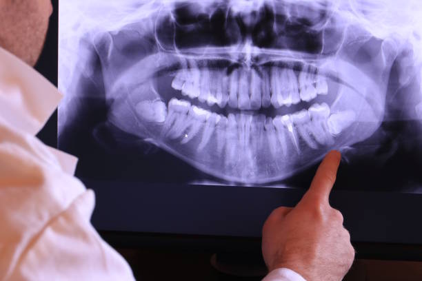 Best 24-Hour Emergency Dental Care in Fredericktown, OH