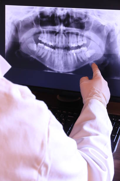 Best Emergency Wisdom Tooth Extraction in Fredericktown, OH